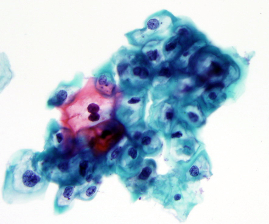Pap Stain